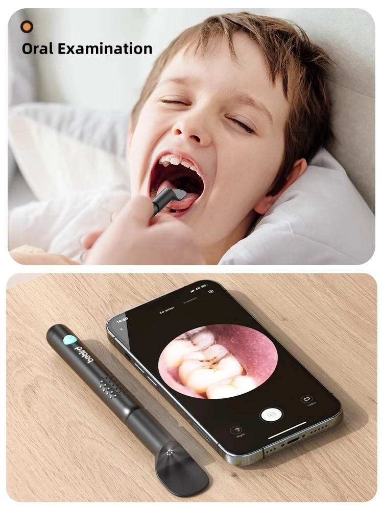 Bebird R3 Ear Cleaner Smart Vi - Pet Ear Cleaner 评论和价格